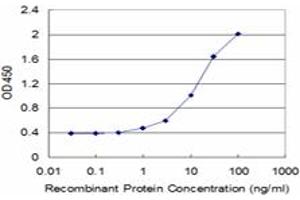 Detection limit for recombinant GST tagged ALAS2 is approximately 0. (ALAS2 antibody  (AA 1-100))