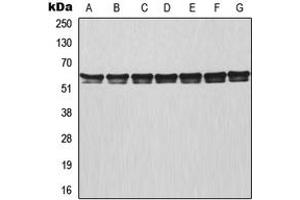 Western blot analysis of TRAF3 expression in MCF7 (A), HeLa (B), Raji (C), NIH3T3 (D), mouse lung (E), rat colon (F), PC12 (G) whole cell lysates. (TRAF3 antibody  (Center))