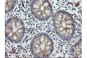 Image no. 7 for anti-Chromosome 2 Open Reading Frame 62 (C2orf62) antibody (ABIN1497054) (C2orf62 antibody)