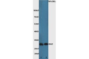 Lane 1:Mouse kidney lysate Lane 2: Mouse brain lysate probed with Rabbit Anti-Bad Polyclonal Antibody, Unconjugated (ABIN674709) at 1:300 overnight at 4 °C. (BAD antibody  (AA 101-204))