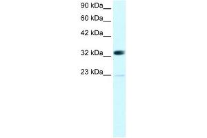 WB Suggested Anti-CBX4 Antibody Titration: 0.