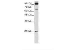 Image no. 2 for anti-Nuclear Factor of Activated T-Cells, Cytoplasmic, Calcineurin-Dependent 4 (NFATC4) (AA 601-650) antibody (ABIN202948) (NFATC4 antibody  (AA 601-650))