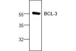Image no. 1 for anti-B-Cell CLL/lymphoma 3 (BCL3) antibody (ABIN127088) (BCL3 antibody)