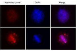 Immunofluorescence (IF) image for anti-Acetylated Lysine (acetylated) antibody (ABIN2666081) (Acetylated Lysine antibody  (acetylated))