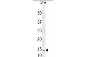 CRCT1 Antibody (N-term) (ABIN653986 and ABIN2843928) western blot analysis in CEM cell line lysates (35 μg/lane).
