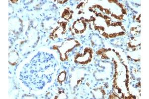 FFPE human renal cell carcinoma tested with MFGE8 antibody (MFG-06) (MFGE8 antibody)