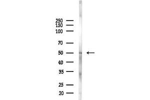 anti-Mannosyl (Alpha-1,6-)-Glycoprotein beta-1,2-N-Acetylglucosaminyltransferase (MGAT2) antibody