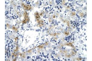 Rabbit Anti-TOP2A antibody  AV Paraffin Embedded Tissue: Human Liver cell Cellular Data: hepatocyte of renal tubule Antibody Concentration: 4. (Topoisomerase II alpha antibody  (C-Term))