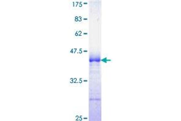 NCK1 Protein (AA 185-294) (GST tag)