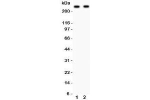Western Blotting (WB) image for anti-Calcium Channel, Voltage-Dependent, L Type, alpha 1D Subunit (CACNA1D) (AA 1-180) antibody (ABIN3030256)