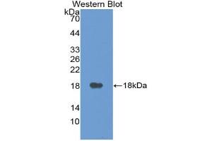 Western blot analysis of the recombinant protein. (VEGFA antibody  (AA 27-145))