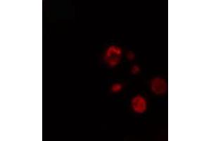 ABIN6274288 staining NIH-3T3 cells by IF/ICC. (LIMK2 antibody  (Internal Region))