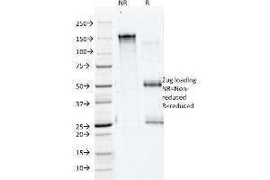 SDS-PAGE Analysis Purified Annexin A1 Mouse Monoclonal Antibody (ANEX 5E4/1). (Annexin a1 antibody)
