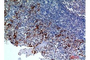 Immunohistochemistry (IHC) analysis of paraffin-embedded Human Tonsils2, antibody was diluted at 1:100. (CMTM8 antibody)