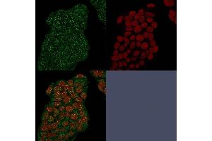Immunofluorescence (IF) image for anti-Secretoglobin, Family 2A, Member 2 (SCGB2A2) antibody (ABIN6940039)