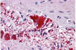 Human Colon, Myenteric Plexus: Formalin-Fixed, Paraffin-Embedded (FFPE) (SSBP2 antibody  (AA 131-180))