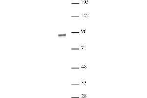 NR3C1 antibody (pAb) tested by Western blot. (Glucocorticoid Receptor antibody)