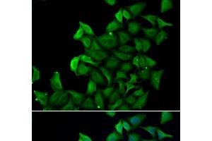 Immunofluorescence analysis of A549 cells using FABP5 Polyclonal Antibody (FABP5 antibody)