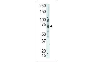 PTPN9 antibody  (C-Term)