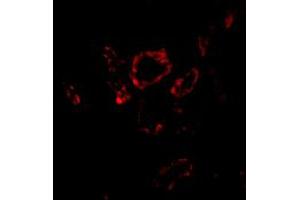 Immunofluorescence of SNAI2 in human kidney tissue with SNAI2 polyclonal antibody  at 20 ug/mL . (SLUG antibody  (Internal Region))