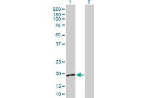 Western Blot analysis of IFNA16 expression in transfected 293T cell line by IFNA16 MaxPab polyclonal antibody. (IFNA16 antibody  (AA 1-189))