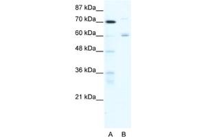 Western Blotting (WB) image for anti-Forkhead Box J2 (FOXJ2) antibody (ABIN2460610)