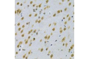 Immunohistochemistry (Paraffin-embedded Sections) (IHC (p)) image for anti-ELAV (Embryonic Lethal, Abnormal Vision, Drosophila)-Like 1 (Hu Antigen R) (ELAVL1) (AA 1-326) antibody (ABIN3022231)