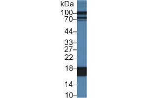 Western Blot; Sample: Porcine Liver lysate; Primary Ab: 1µg/ml Rabbit Anti-Porcine FABP1 Antibody Second Ab: 0. (FABP1 antibody  (AA 1-127))