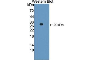 Detection of Recombinant VNN1, Bovine using Polyclonal Antibody to Vanin 1 (VNN1) (VNN1 antibody  (AA 216-469))