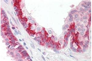 Human Prostate: Formalin-Fixed, Paraffin-Embedded (FFPE) (KEAP1 antibody  (C-Term))