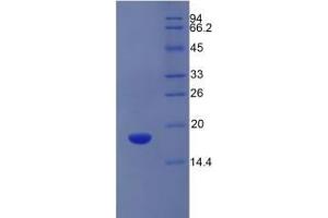 SDS-PAGE of Protein Standard from the Kit (Highly purified E. (SLC3A2 ELISA Kit)