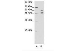 Image no. 1 for anti-Zinc Finger Protein 682 (ZNF682) (AA 35-84) antibody (ABIN202663) (ZNF682 antibody  (AA 35-84))
