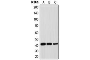 Western blot analysis of Thrombopoietin expression in HepG2 (A), mouse liver (B), rat liver (C) whole cell lysates. (Thrombopoietin antibody  (Center))