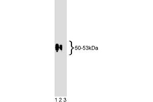 Western blot analysis of EBP50 on human endothelial cell lysate. (SLC9A3R1 antibody  (AA 128-249))