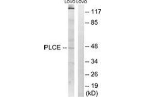 Western Blotting (WB) image for anti-1-Acylglycerol-3-Phosphate O-Acyltransferase 5 (Lysophosphatidic Acid Acyltransferase, Epsilon) (AGPAT5) (AA 241-290) antibody (ABIN2890035) (AGPAT5 antibody  (AA 241-290))