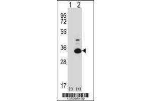 Western blot analysis of Tp53rk using rabbit polyclonal Mouse Tp53rk Antibody using 293 cell lysates (2 ug/lane) either nontransfected (Lane 1) or transiently transfected (Lane 2) with the Tp53rk gene. (TP53RK antibody  (AA 100-128))