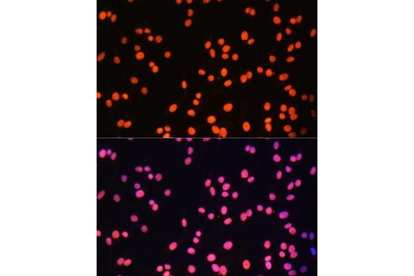 ZNF581 antibody  (AA 1-90)