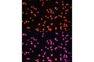 Immunofluorescence analysis of C6 cells using ZNF581 Polyclonal Antibody (ABIN6128960, ABIN6150520, ABIN6150521 and ABIN6217055) at dilution of 1:100 (40x lens).