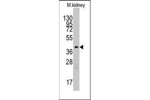 Western blot analysis of anti-TBRG1 Pab in mouse kidney tissue lysates (35ug/lane). (TBRG1 antibody  (N-Term))