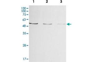 Western blot analysis of Enpp2 from zebrafish embryo lysate by Enpp2 polyclonal antibody ( Cat # PAB8520 ) (1:500, 4°C, overnight). (ENPP2 antibody)