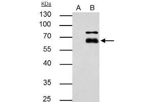 Immunoprecipitation (IP) image for anti-Matrix Metallopeptidase 8 (Neutrophil Collagenase) (MMP8) antibody (ABIN2856104)