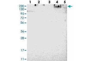Western blot analysis of Lane 1: RT-4, Lane 2: U-251 MG, Lane 3: Human Plasma, Lane 4: Liver, Lane 5: Tonsil with SPTBN1 polyclonal antibody . (SPTBN1 antibody)
