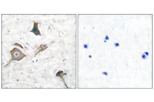 Immunohistochemistry (IHC) image for anti-Matrix Metallopeptidase 16 (Membrane-inserted) (MMP16) (C-Term) antibody (ABIN1848678) (MMP16 antibody  (C-Term))