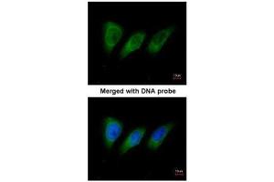 ICC/IF Image Immunofluorescence analysis of paraformaldehyde-fixed HeLa, using protein kinase N2, antibody at 1:200 dilution. (PKN2 antibody)