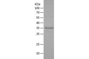 Western Blotting (WB) image for Interferon Regulatory Factor 2 Binding Protein 2 (IRF2BP2) (AA 72-174) protein (His-IF2DI Tag) (ABIN7123495) (IRF2BP2 Protein (AA 72-174) (His-IF2DI Tag))