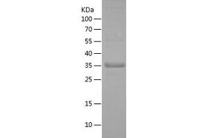 Western Blotting (WB) image for Interferon Regulatory Factor 2 Binding Protein 2 (IRF2BP2) (AA 72-174) protein (His-IF2DI Tag) (ABIN7123495)