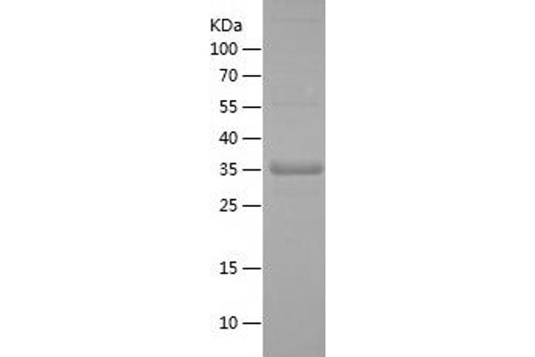 IRF2BP2 Protein (AA 72-174) (His-IF2DI Tag)