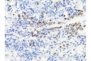 Immunohistochemistry of paraffin-embedded rat spleen using S100A9 antibody. (S100A9 antibody)