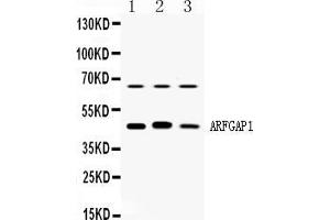 Western blot analysis of ARFGAP1 expression in rat brain extract ( Lane 1), mouse brain extract ( Lane 2) and HELA whole cell lysates ( Lane 3). (ARFGAP1 antibody  (AA 1-183))