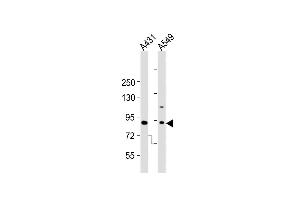 All lanes : Anti-Dnmt3b Antibody  at 1:2000 dilution Lane 1: A431 whole cell lysates Lane 2: A549 whole cell lysates Lysates/proteins at 20 μg per lane. (DNMT3B antibody  (AA 389-417))